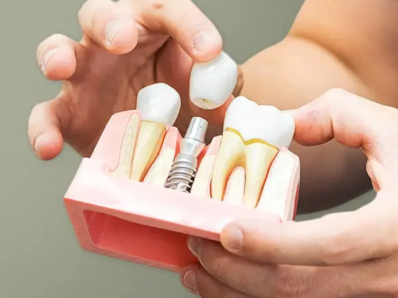 Restorative dentistry at Landmark Dental.